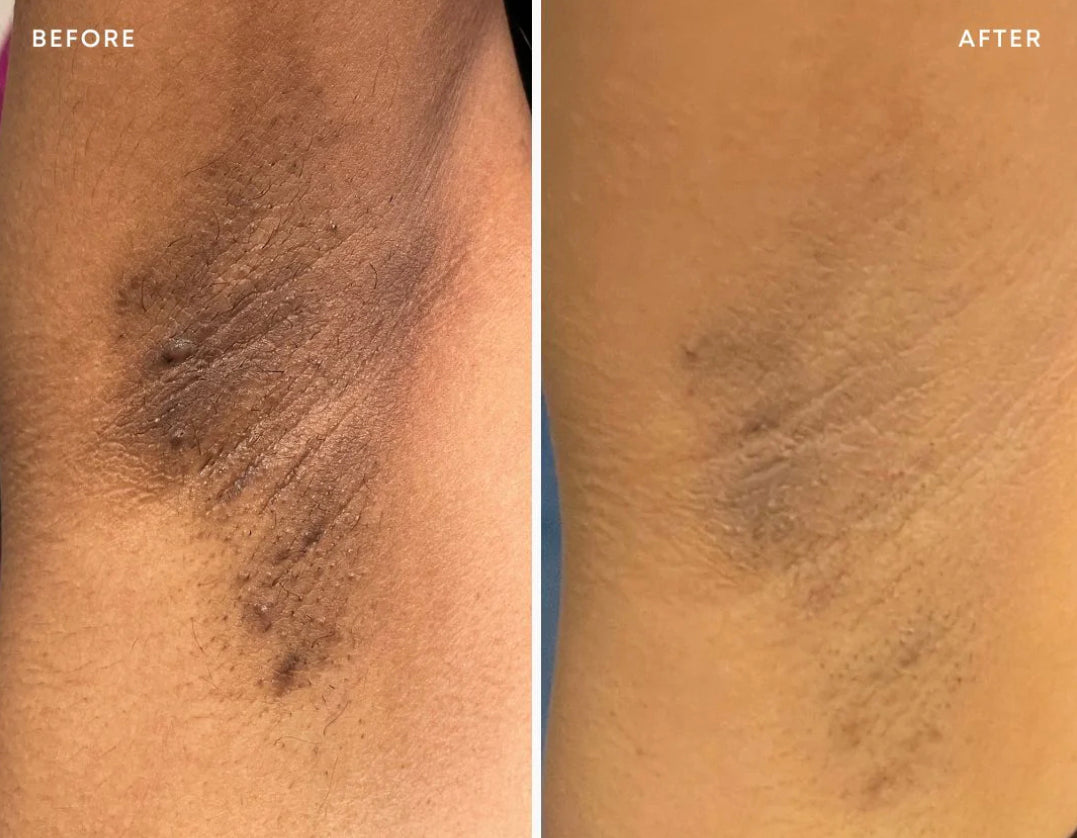 Dark Spot Exfoliating Scrub
clear pores + brighten