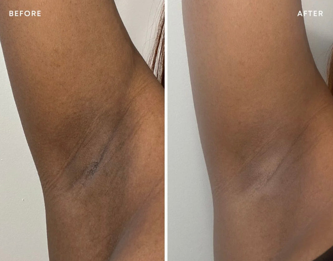 Dark Spot Oil
rejuvenate + brighten