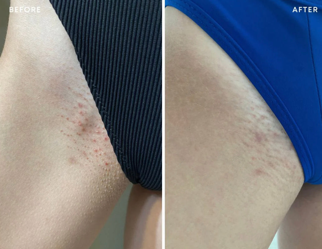 Ingrown Hair Exfoliating Scrub
clear pores + hydrate